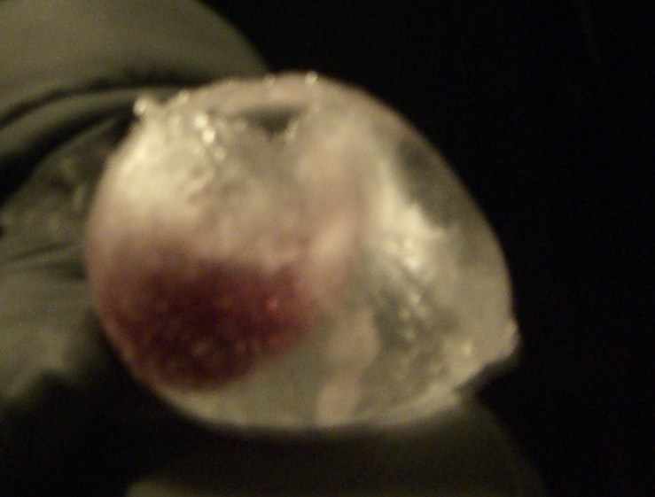 nite ice nipple