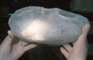 Fell in Asturias, Spain, 2000 (photo from Martinez-Frias' website cited in this post)